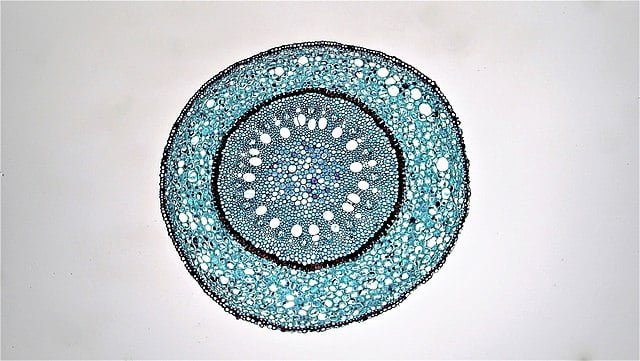 Internal structure of monocot root (Smilax)